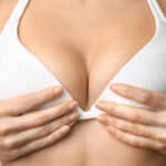 illustration of a breast lift procedure