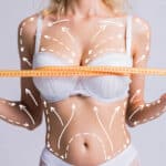 breast fat grafting procedure concept image