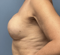 Wise Pattern Reconstruction