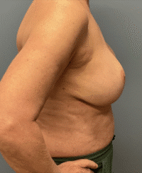 Wise Pattern Reconstruction