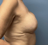 Wise Pattern Reconstruction