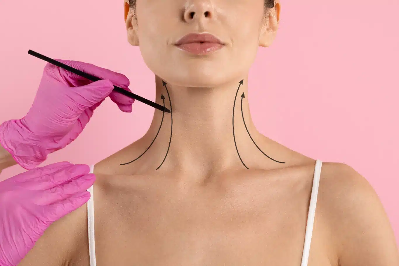 illustrating cosmetic neck lift procedure Neck contouring procedure illustration with marked lines on womans neck